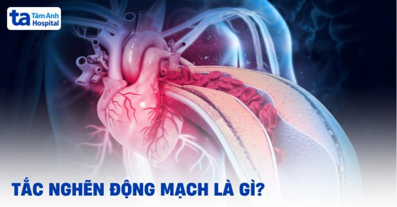 Hình ảnh minh họa các yếu tố lối sống lành mạnh (ăn uống, tập thể dục, không hút thuốc) hỗ trợ điều trị hội chứng tắc nghẽn đường hô hấp dưới.